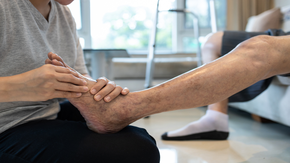 Der Fuß einer Frau, die an diabetischem Fußsyndrom leidet, wird gerade von einer Pflegekraft massiert.