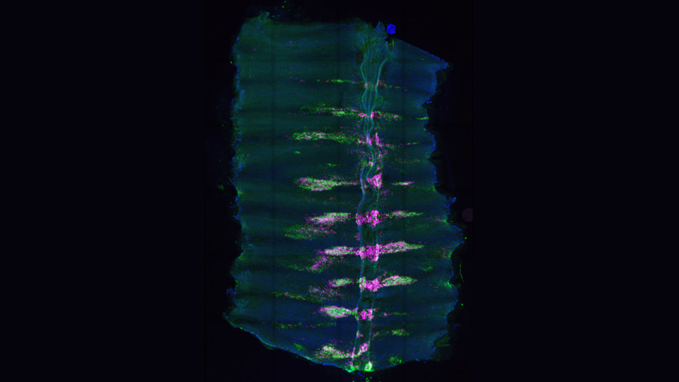 Immunhistochemische Färbung der Luftröhre 