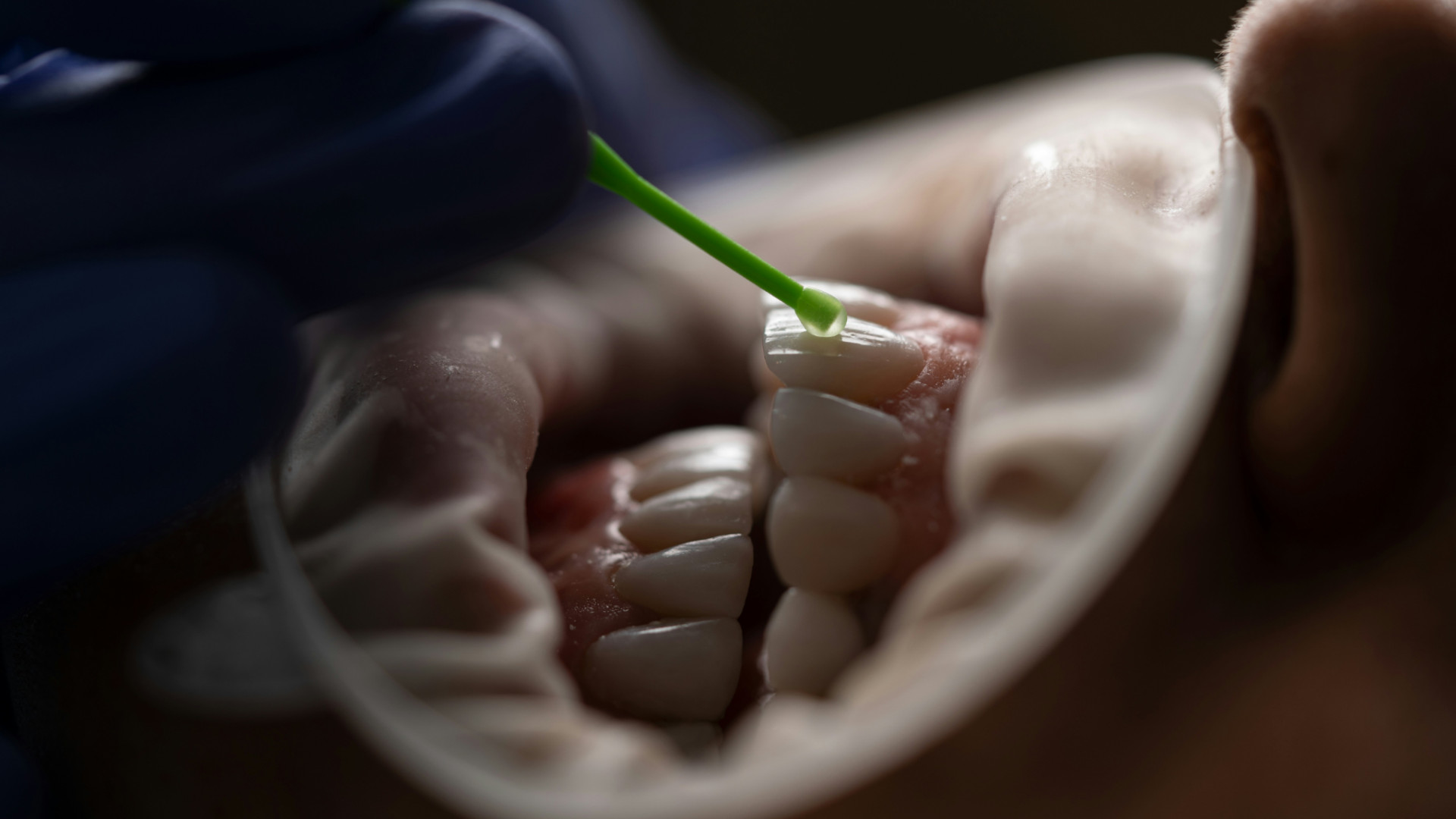 Nahaufnahme: Zahnbehandlung